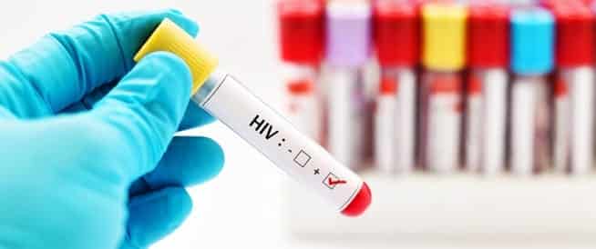 علاج مرض الأيدز HIV في تايلند 1