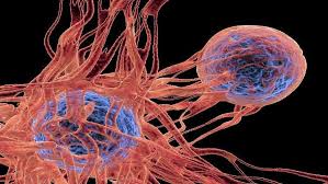 سرطان الأنسجة غير معروف المنشأ